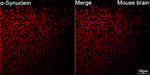 alpha Synuclein Antibody in Immunohistochemistry (Paraffin) (IHC (P))