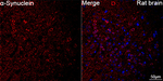 alpha Synuclein Antibody in Immunohistochemistry (Paraffin) (IHC (P))