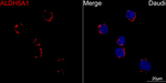 ALDH5A1 Antibody in Immunocytochemistry (ICC/IF)
