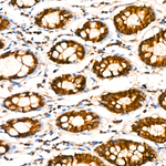 ALDH5A1 Antibody in Immunohistochemistry (Paraffin) (IHC (P))