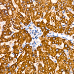 ALDH5A1 Antibody in Immunohistochemistry (Paraffin) (IHC (P))