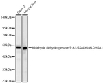 ALDH5A1 Antibody in Western Blot (WB)