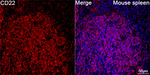 CD22 Antibody in Immunohistochemistry (Paraffin) (IHC (P))