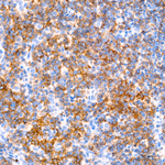 CD22 Antibody in Immunohistochemistry (Paraffin) (IHC (P))