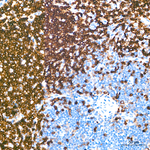 CD22 Antibody in Immunohistochemistry (Paraffin) (IHC (P))