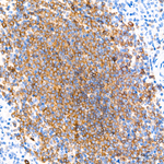 CD22 Antibody in Immunohistochemistry (Paraffin) (IHC (P))