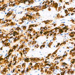 PSMA Recombinant Rabbit Monoclonal Antibody (9B9A6)