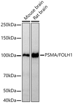 PSMA Antibody in Western Blot (WB)