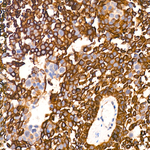 CD104 Antibody in Immunohistochemistry (Paraffin) (IHC (P))