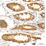 CD104 Antibody in Immunohistochemistry (Paraffin) (IHC (P))