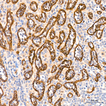 CD104 Antibody in Immunohistochemistry (Paraffin) (IHC (P))