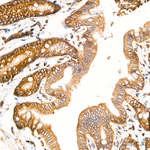 CD104 Antibody in Immunohistochemistry (Paraffin) (IHC (P))