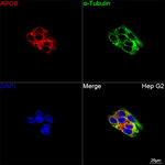 Apolipoprotein B Recombinant Rabbit Monoclonal Antibody (3J6C5)