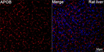 Apolipoprotein B Antibody in Immunohistochemistry (Paraffin) (IHC (P))