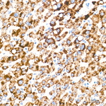 EHHADH Antibody in Immunohistochemistry (Paraffin) (IHC (P))