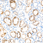 EHHADH Antibody in Immunohistochemistry (Paraffin) (IHC (P))