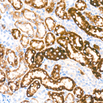 EHHADH Antibody in Immunohistochemistry (Paraffin) (IHC (P))