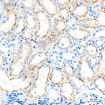 EHHADH Antibody in Immunohistochemistry (Paraffin) (IHC (P))