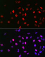 H3K23ac Antibody in Immunocytochemistry (ICC/IF)