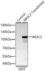 NR3C2 Recombinant Rabbit Monoclonal Antibody (5I6I0)