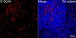 S100A9 Antibody in Immunohistochemistry (Paraffin) (IHC (P))