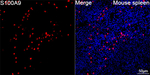 S100A9 Recombinant Rabbit Monoclonal Antibody (5T7Y9)