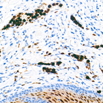 S100A9 Antibody in Immunohistochemistry (Paraffin) (IHC (P))