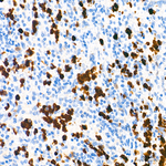 S100A9 Antibody in Immunohistochemistry (Paraffin) (IHC (P))