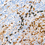 S100A9 Antibody in Immunohistochemistry (Paraffin) (IHC (P))