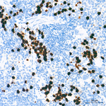 S100A9 Antibody in Immunohistochemistry (Paraffin) (IHC (P))