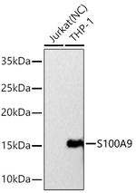 S100A9 Antibody in Western Blot (WB)