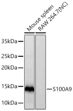 S100A9 Antibody in Western Blot (WB)