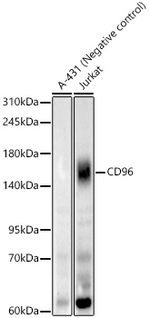 CD96 Recombinant Rabbit Monoclonal Antibody (8L2X5)