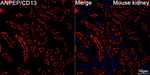 CD13 Antibody in Immunohistochemistry (Paraffin) (IHC (P))
