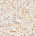 CD13 Antibody in Immunohistochemistry (Paraffin) (IHC (P))