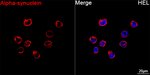 alpha Synuclein Recombinant Mouse Monoclonal Antibody (2E2Y10)