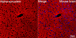 alpha Synuclein Antibody in Immunohistochemistry (Paraffin) (IHC (P))