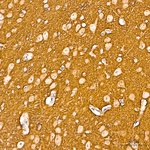 alpha Synuclein Antibody in Immunohistochemistry (Paraffin) (IHC (P))