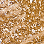 alpha Synuclein Antibody in Immunohistochemistry (Paraffin) (IHC (P))