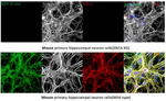 alpha Synuclein Recombinant Rabbit Monoclonal Antibody (4J7Y6)