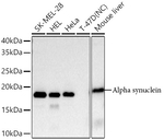 alpha Synuclein Antibody in Western Blot (WB)
