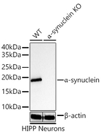alpha Synuclein Antibody in Western Blot (WB)