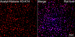 H3K14ac Antibody in Immunohistochemistry (Paraffin) (IHC (P))