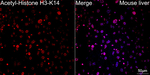H3K14ac Antibody in Immunohistochemistry (Paraffin) (IHC (P))