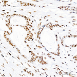 H3K14ac Antibody in Immunohistochemistry (Paraffin) (IHC (P))