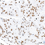 H3K14ac Antibody in Immunohistochemistry (Paraffin) (IHC (P))