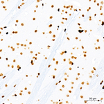H3K14ac Antibody in Immunohistochemistry (Paraffin) (IHC (P))