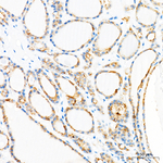 Occludin Antibody in Immunohistochemistry (Paraffin) (IHC (P))