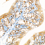 Occludin Antibody in Immunohistochemistry (Paraffin) (IHC (P))