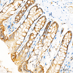 Occludin Antibody in Immunohistochemistry (Paraffin) (IHC (P))